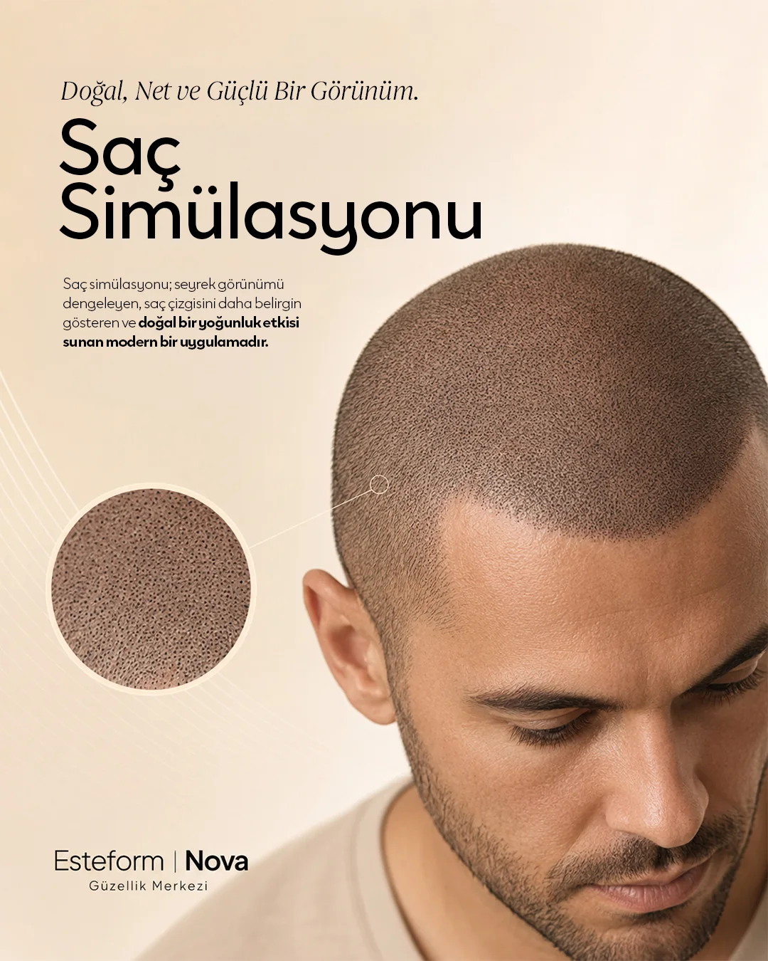Başını eğmiş adam ve yakın çekim saç dokusu dairesi; "Saç Simülasyonu" başlığı.